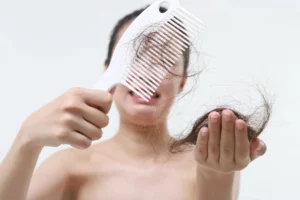 Conheça as principais vitaminas para evitar queda de cabelo - reprodução internet