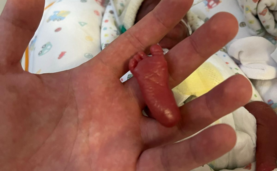 Tocantins realiza seminário para prevenir prematuridade e melhorar atenção neonatal; inscrições abertas