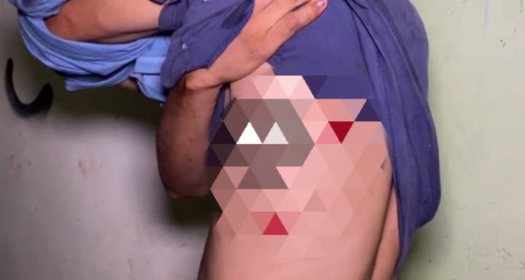 Homem em situação de rua é baleado com quatro tiros durante a madrugada em Araguaína